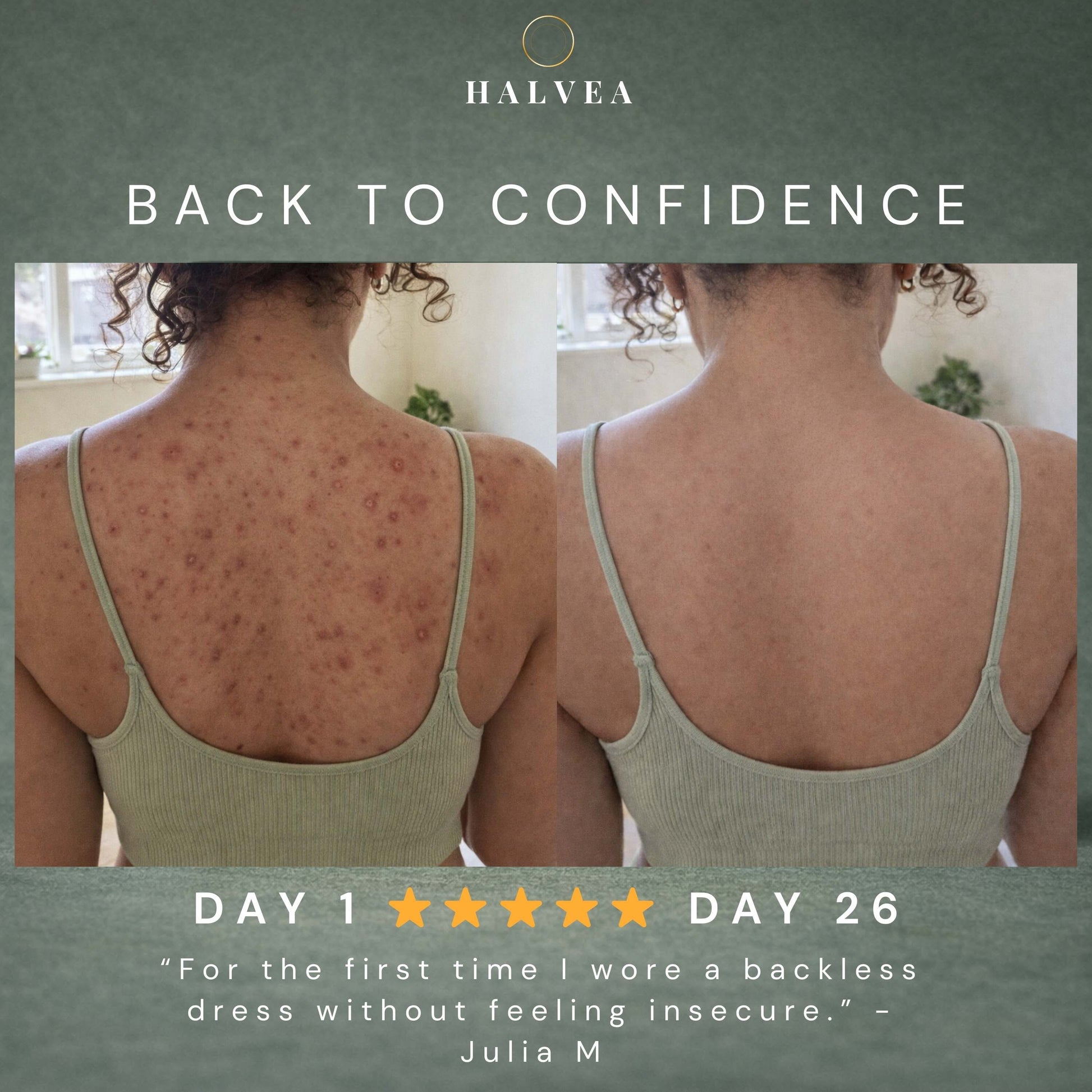 Bacne Out Soap Bar™ Soap null