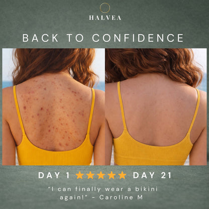 Bacne Out Soap Bar™ Soap null